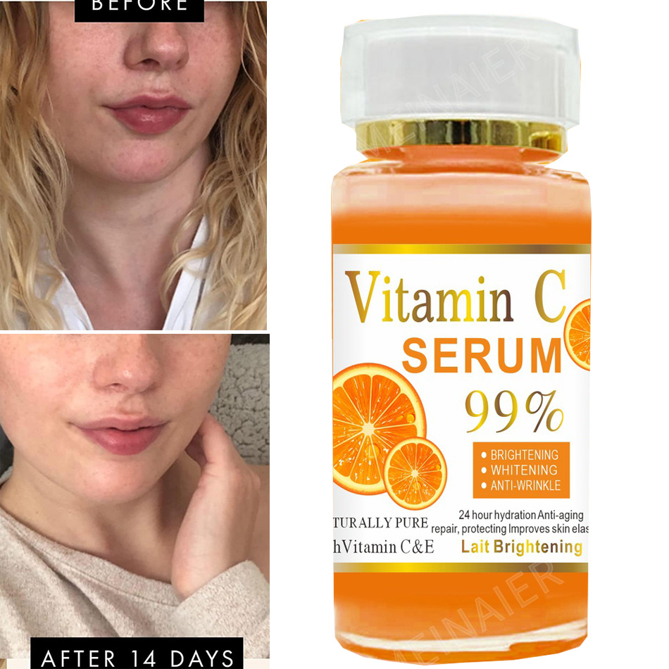 Suero de vitamina C súper 120m - Vitamin C Serum Face reseña y precio