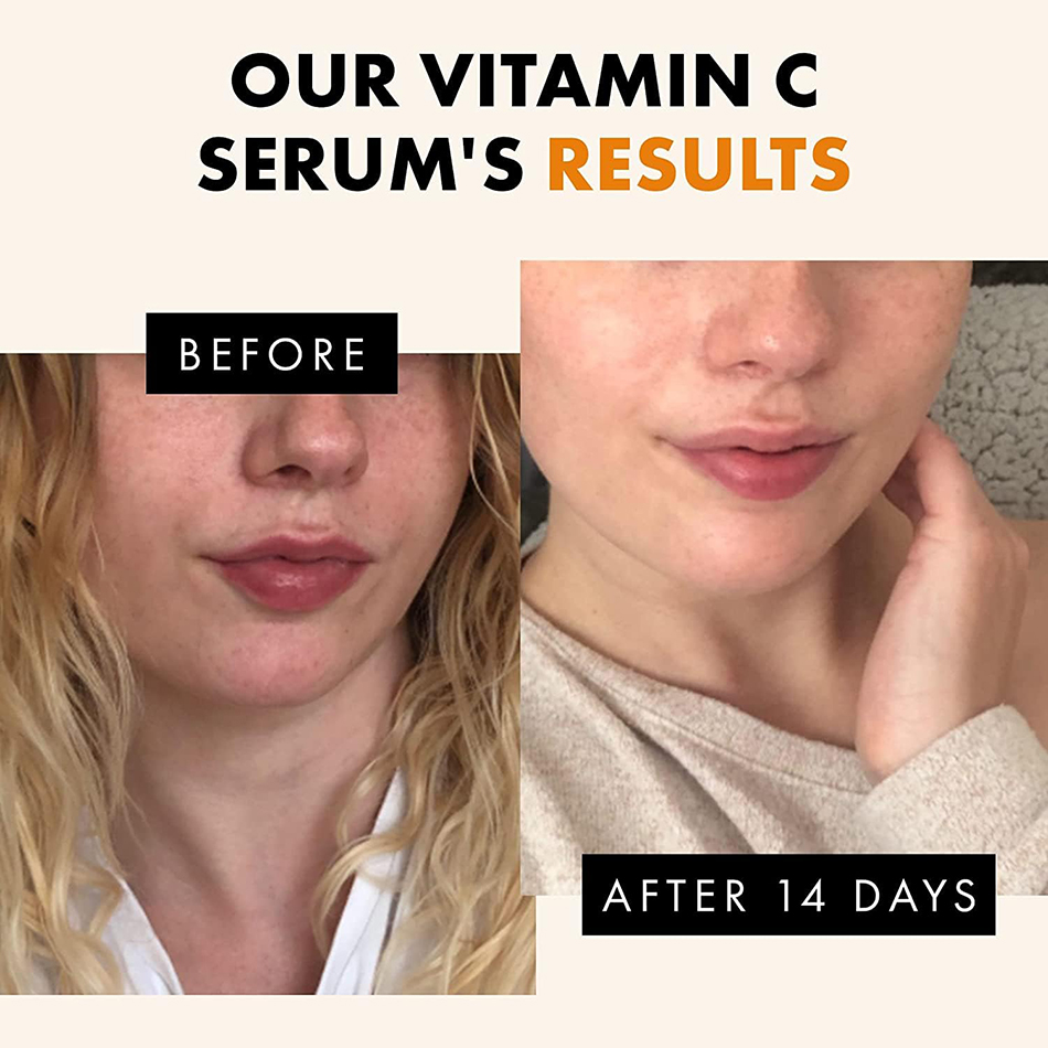 Suero de vitamina C súper 120m - Vitamin C Serum Face reseña y precio